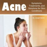 Acne Symptoms, Treatments, and Solutions for Skin Conditions