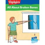 All About Broken Bones Voices Leveled Library Readers, Sally Speer Leber