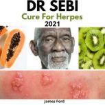 Dr. Sebi Cure for Herpes 2021 How to Naturally Cure Herpes Simplex Virus with Dr. Sebi's Alkaline Diet, Nutritional Guide, Food List and Herbs