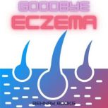 Goodbye Eczema A Method Of Eczema Treatment That Is Both All-Natural and Risk-Free, Behnay Books