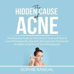 The Hidden Cause of Acne: the Essential Guide on the Cause of Acne and How to Cure it Permanently, Discover the Cause and Treatments Available to Get Rid of Acne Permanently, Sophie Randal