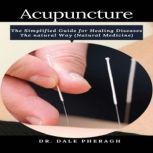 Acupuncture The Simplified Guide for Healing Diseases The natural Way (Natural Medicine)