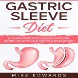 Gastric Sleeve Diet: A Concise Guide for Planning What to Do Before and After your Gastric Sleeve Surgery, Mike Edwards