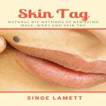 Skin Tag : Natural DIY Methods of removing Mole, Wart and Skin Tag