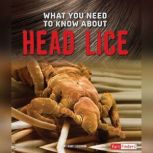 What You Need to Know about Head Lice, Nancy Dickmann