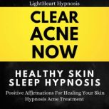 Clear Acne Now Healthy Skin Sleep Hypnosis Positive Affirmations For Healing Your Skin. Hypnosis Acne Treatment