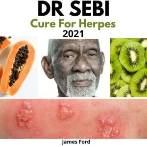 Dr. Sebi Cure for Herpes 2021: How to Naturally Cure Herpes Simplex Virus with Dr. Sebi's Alkaline Diet, Nutritional Guide, Food List and Herbs, James Ford